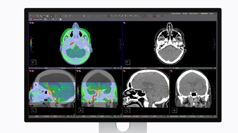 Diagnostic medical images displayed on the Studio Display XDR highlighting DICOM preset compliance.
